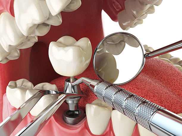 Best Pediatric Emergency Dentist in St Martinville, LA